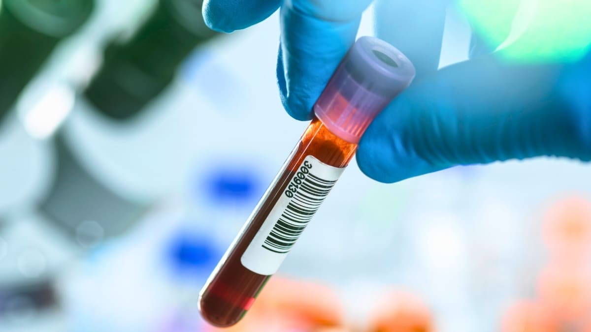 Cancer Blood Tests Show Promise Despite Early Setbacks