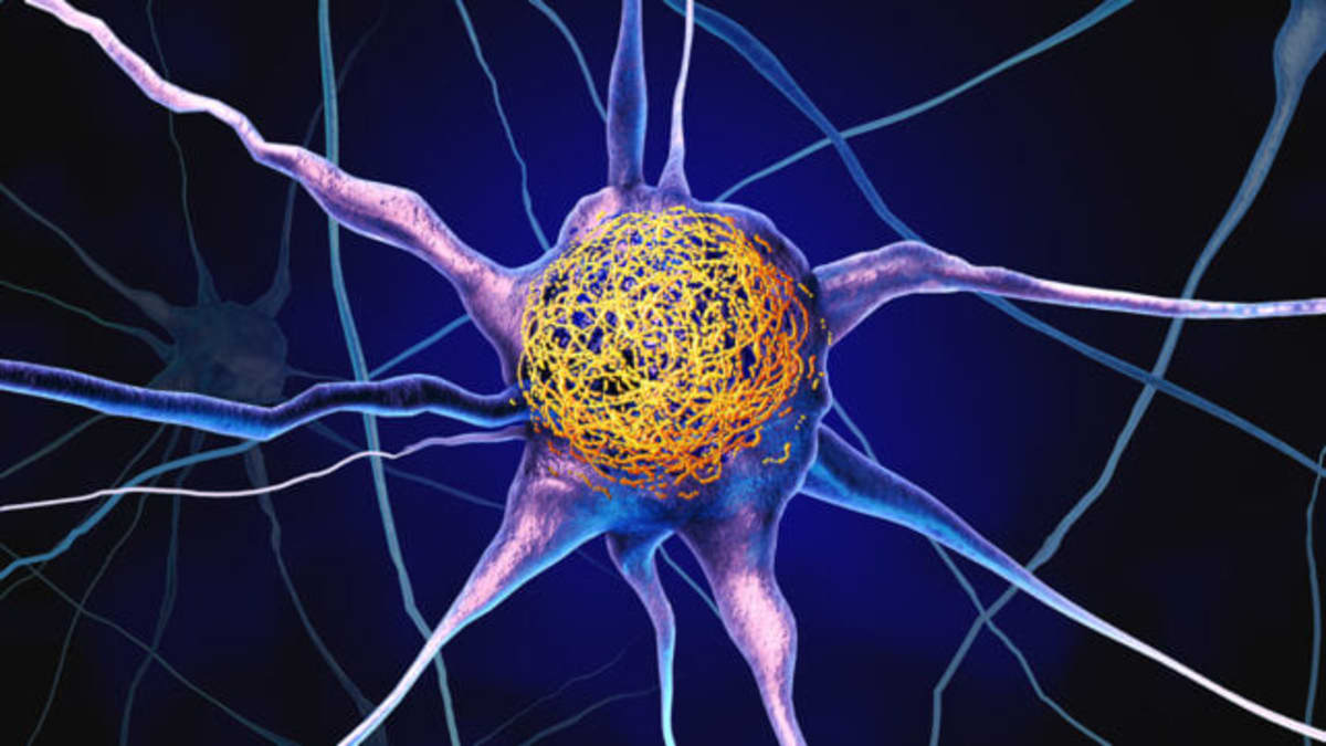 Vitamin D Linked to Lower Alzheimer's Risk in New Study - Image 2