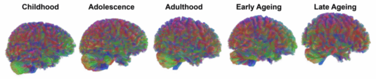 Scientists Map How Pregnancy Transforms the Brain - Image 4