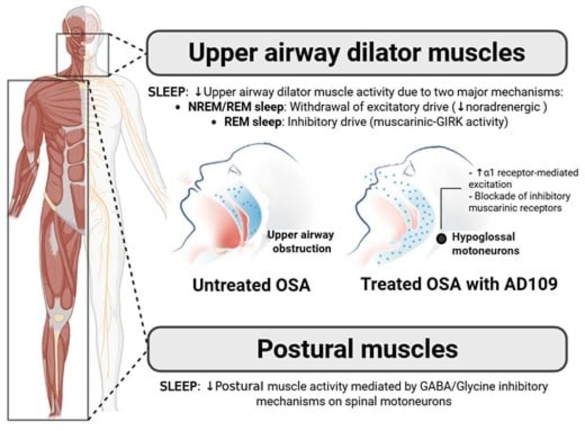 Sleep Apnea Pill Cuts Breathing Pauses 44% in Major Trial - Image 5