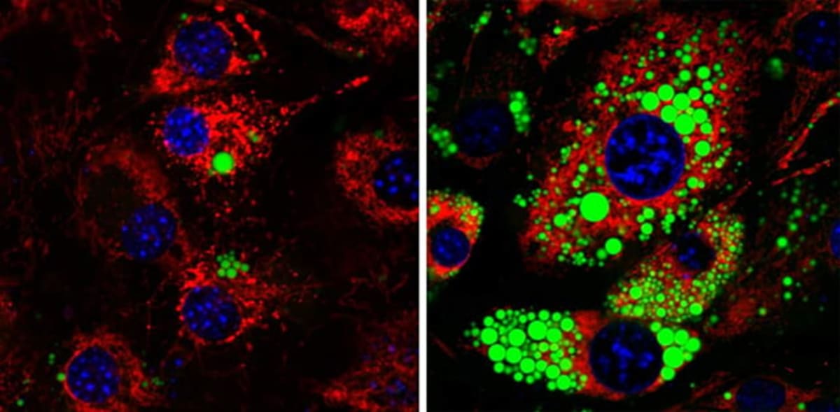 Scientists Find 'Mitch' Protein Controls Fat Cell Growth - Image 4