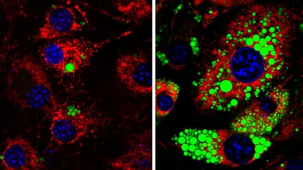 Microscope image showing fat cells with and without MTCH2 protein highlighting differences in fat storage