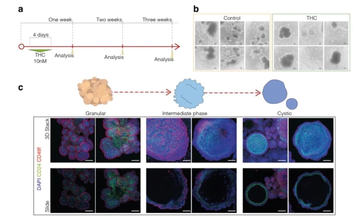Cannabis Compound Stops Breast Cancer Cells from Spreading - Image 5