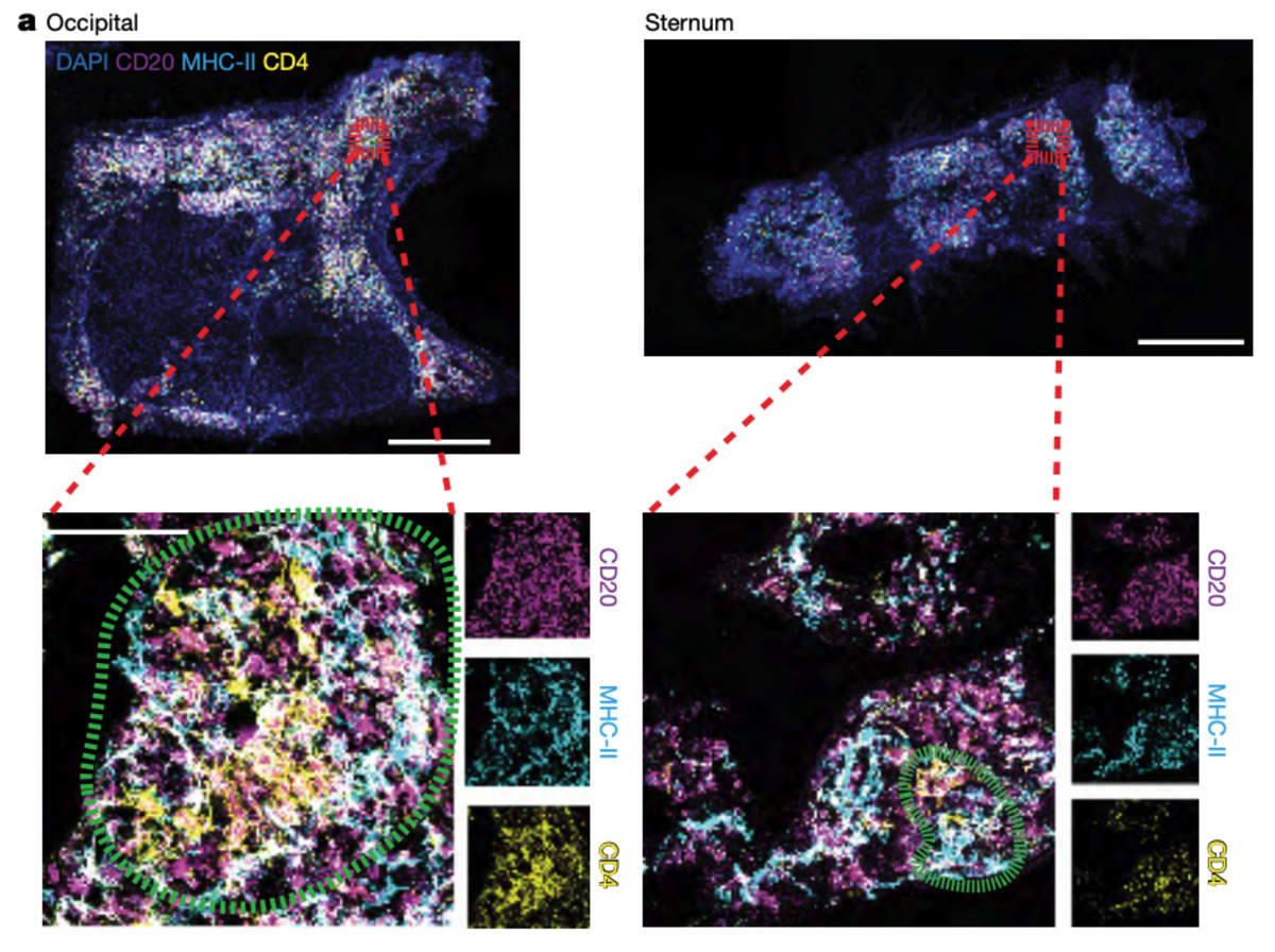 Scientists Find New Immune Organ Hidden in Mouse Skulls - Image 3