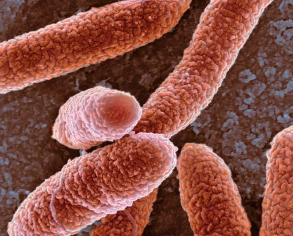 Scientists Find Bacteria Making DNA From Protein, Not DNA - Image 4