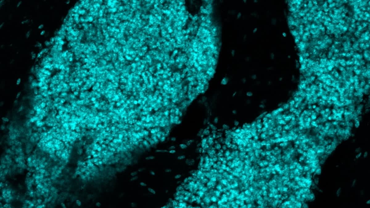 Microscope image showing newly discovered immune cell clusters in mouse skull bone marrow tissue