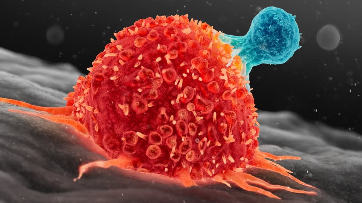 CT scan comparison showing complete disappearance of liver tumor after experimental immunotherapy treatment