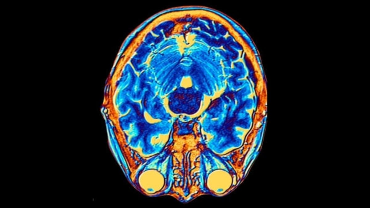 Scientists Discover Human Brain Has Two Separate Origins - Image 2