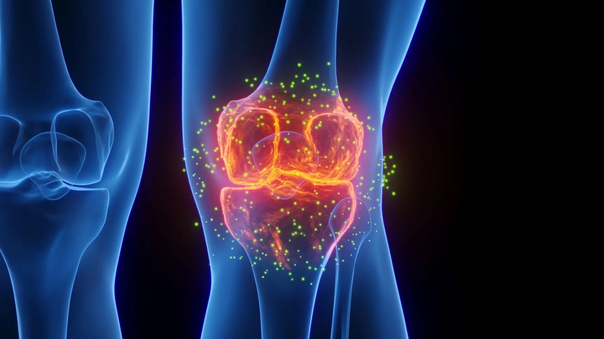Knee Pain Treatment Offers Relief Without Surgery