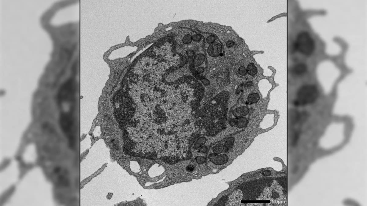 Electron microscopy comparing healthy stem cells with and without MLKL protein damage
