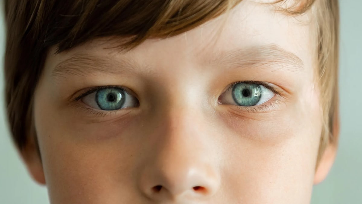Indigo Light Could Stop Myopia in 5 Billion Kids by 2050