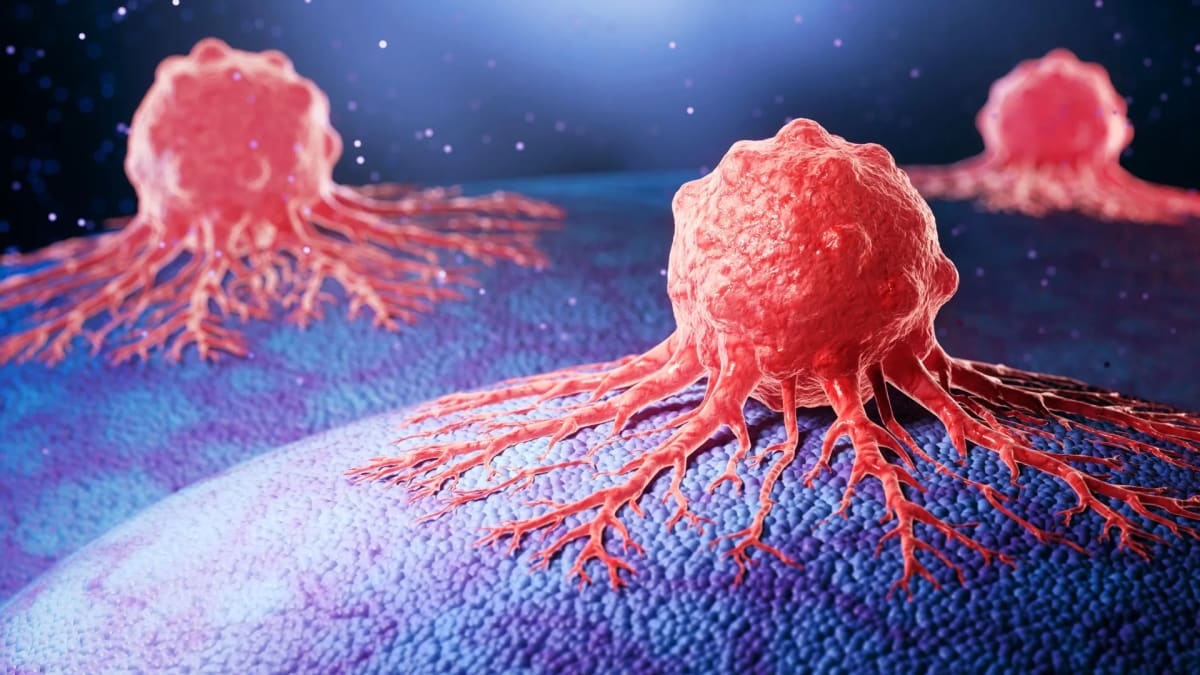 New Antibody Stops Aggressive Prostate Cancer Spread