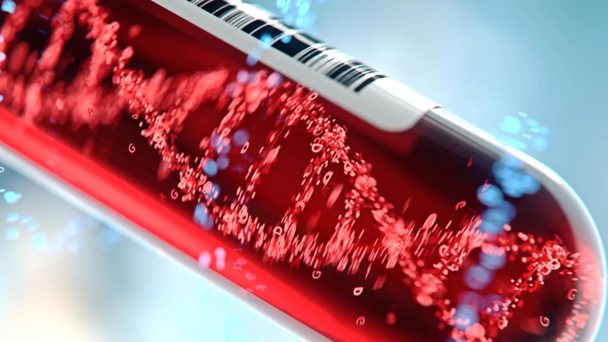 AI Blood Test Spots Silent Liver Disease Years Early