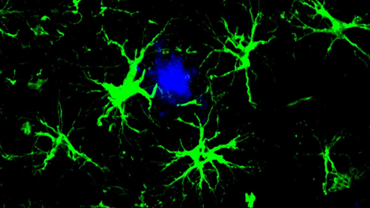 Scientists Turn Brain Cells Into Alzheimer's Plaque Cleaners