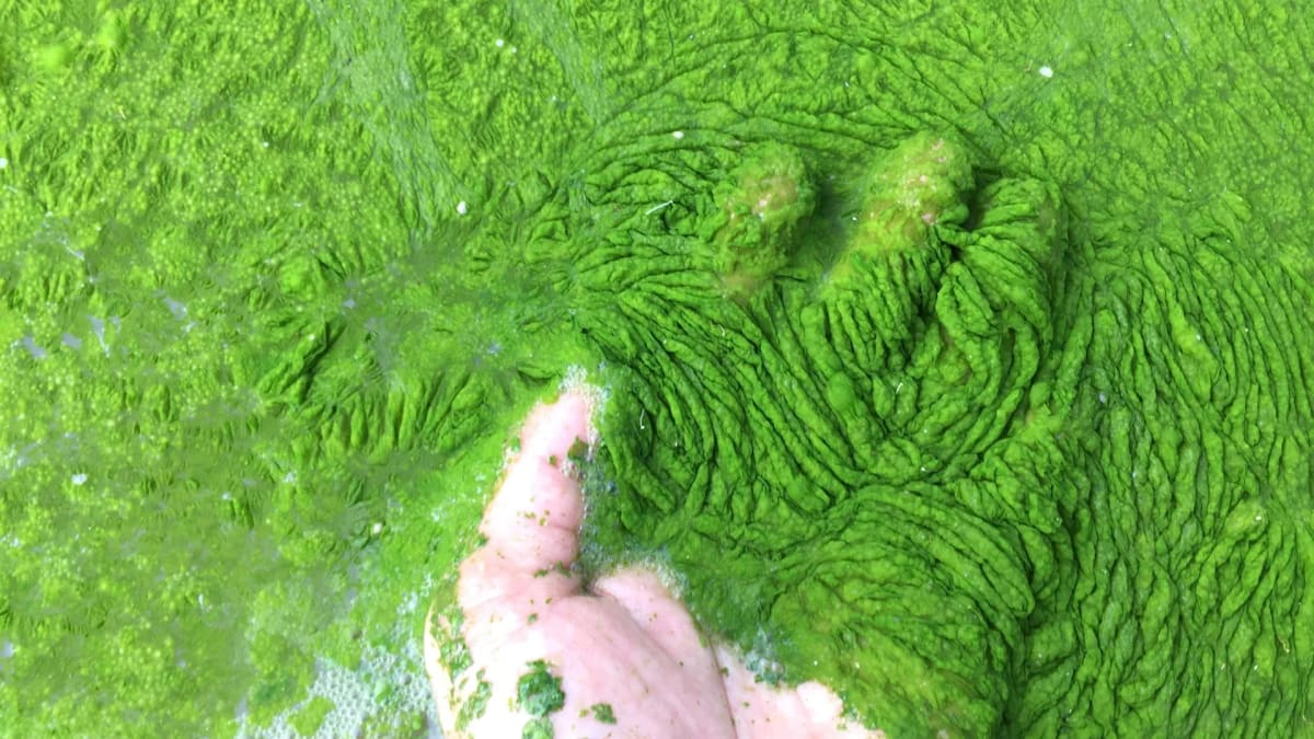 Microscopic view of marine fungus attacking toxic algae cells in ocean water sample