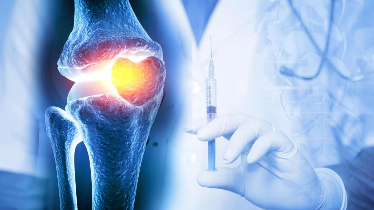One Shot Could Treat Knee Arthritis for Weeks