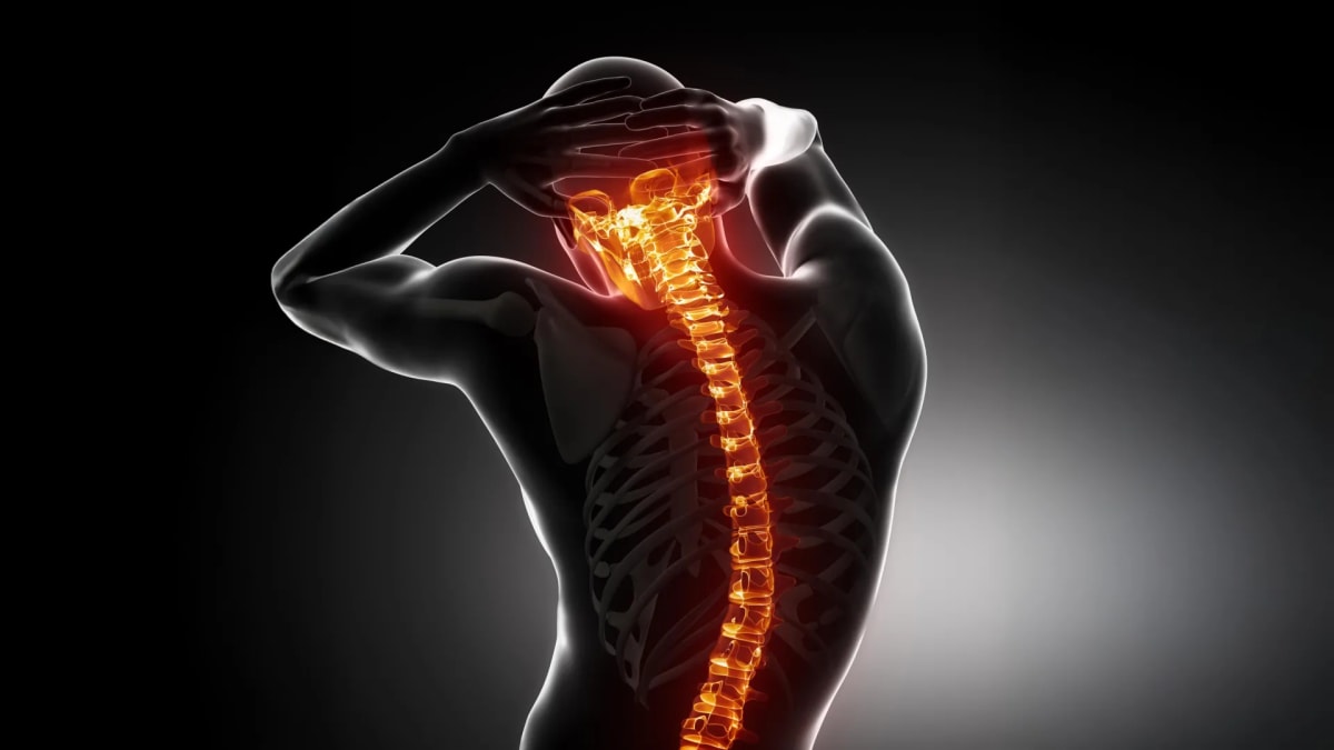 Osteoporosis Drug Shows Promise for Back Pain Relief
