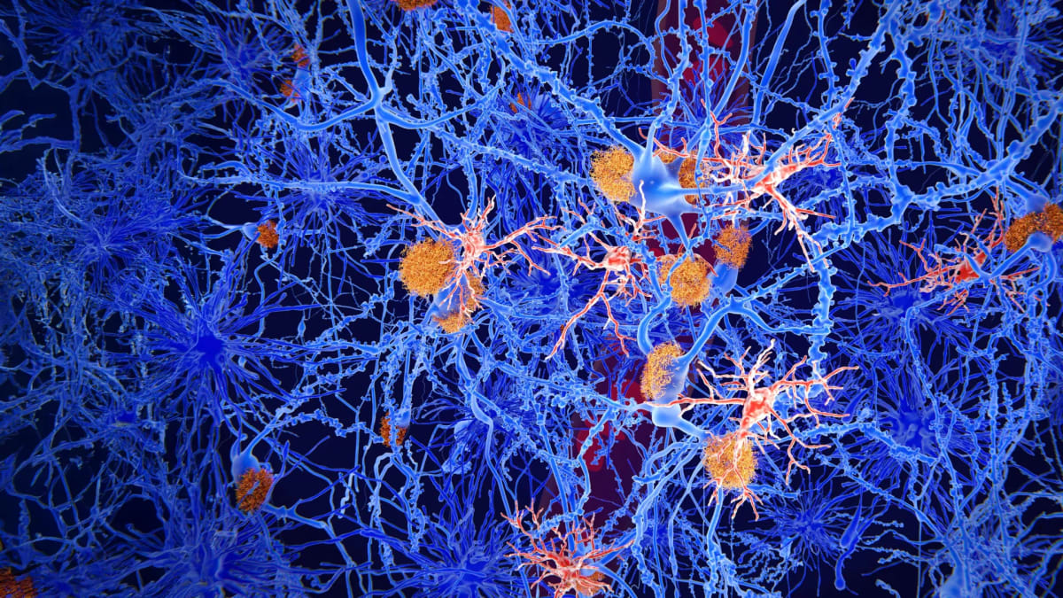 Microscopic view of brain immune cells surrounding and protecting neurons from damage