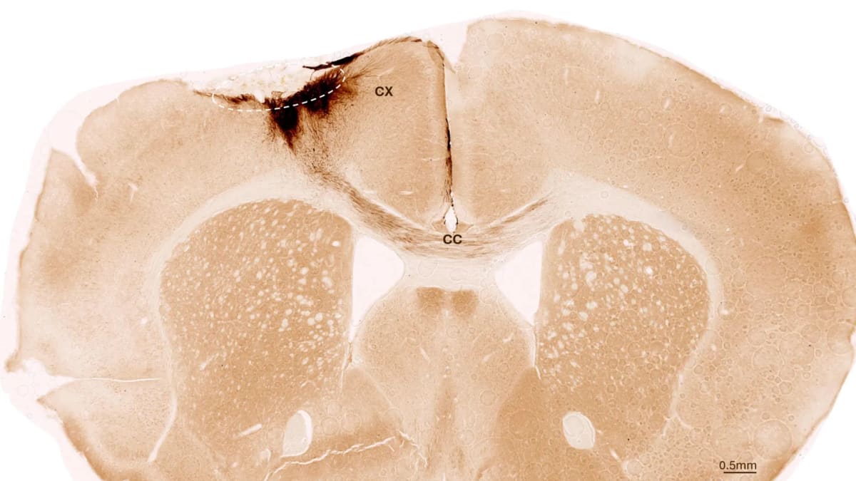 Microscope image showing transplanted stem cells extending dark brown projections through mouse brain tissue after stroke