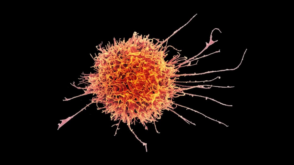 Colorized microscope image showing a natural killer immune cell from human donor tissue sample