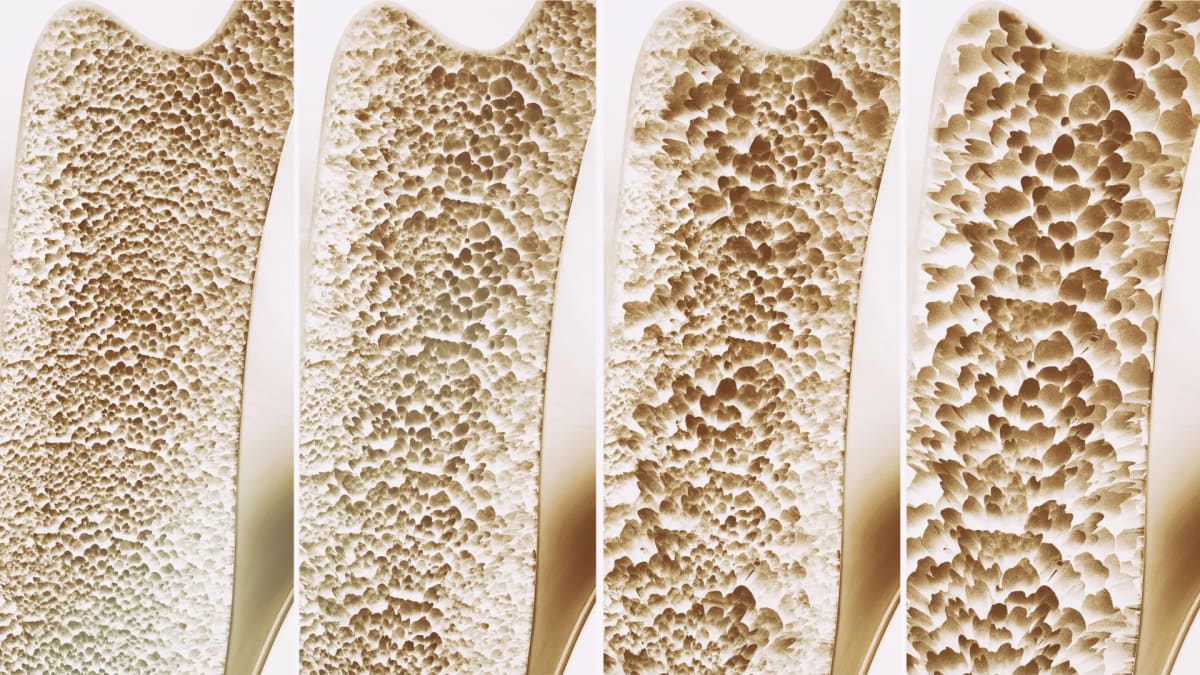 Microscopic view of healthy bone tissue showing cellular structure and density improvements