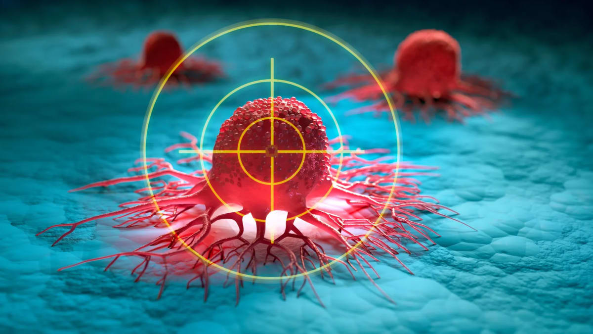 Medical researchers examining prostate cancer cells under microscope in laboratory setting