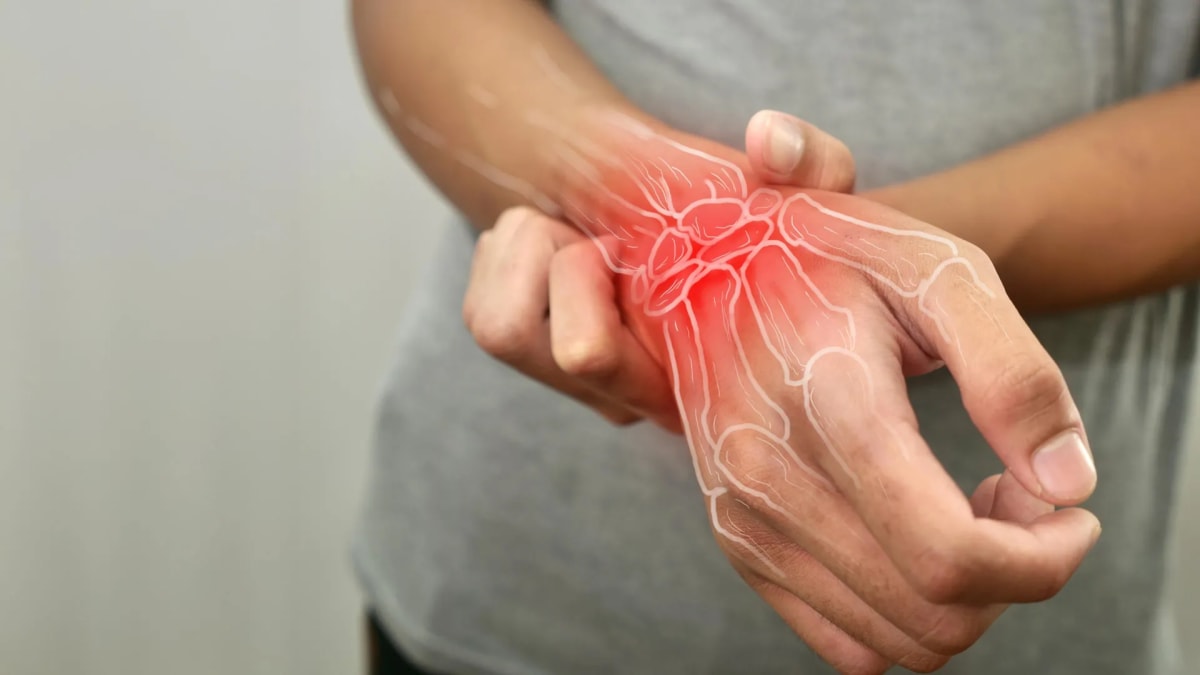 Drug Delays Arthritis Up to 4 Years After Treatment Ends