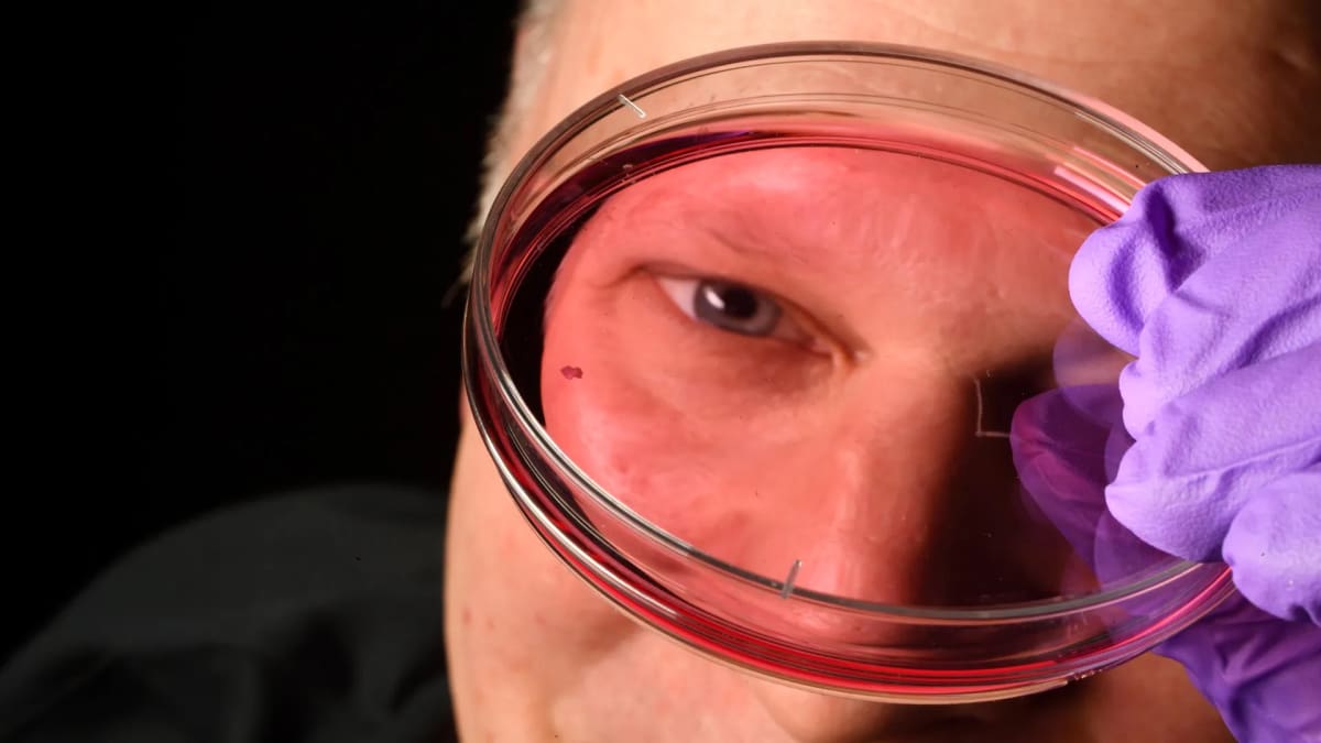 Scientist holding petri dish containing lab grown human retinal tissue used for vision research
