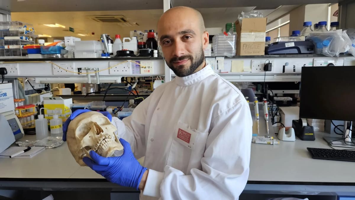 Scientist at King's College London holds skull while researching wool-based bone repair material