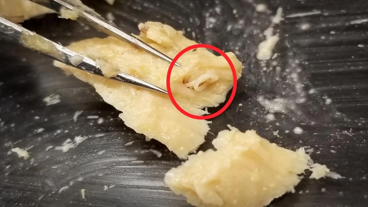 Close-up view of tiny anisakid worm circled in red inside preserved salmon fillet tissue