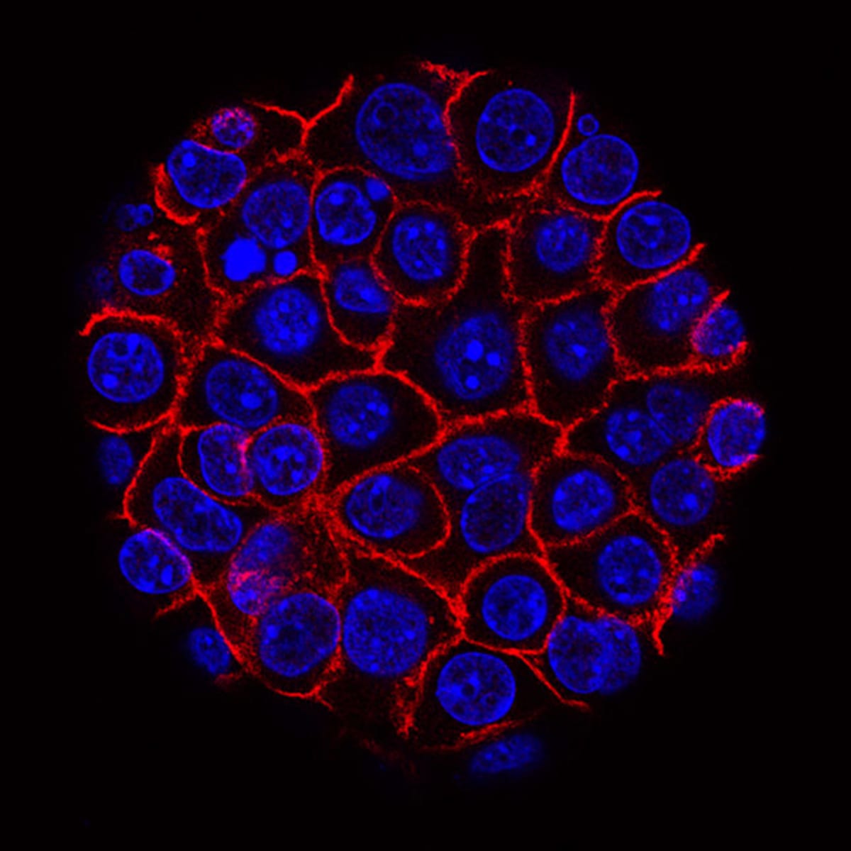 New Pancreatic Cancer Drug Combo Shows 'Unprecedented' Results - Image 2