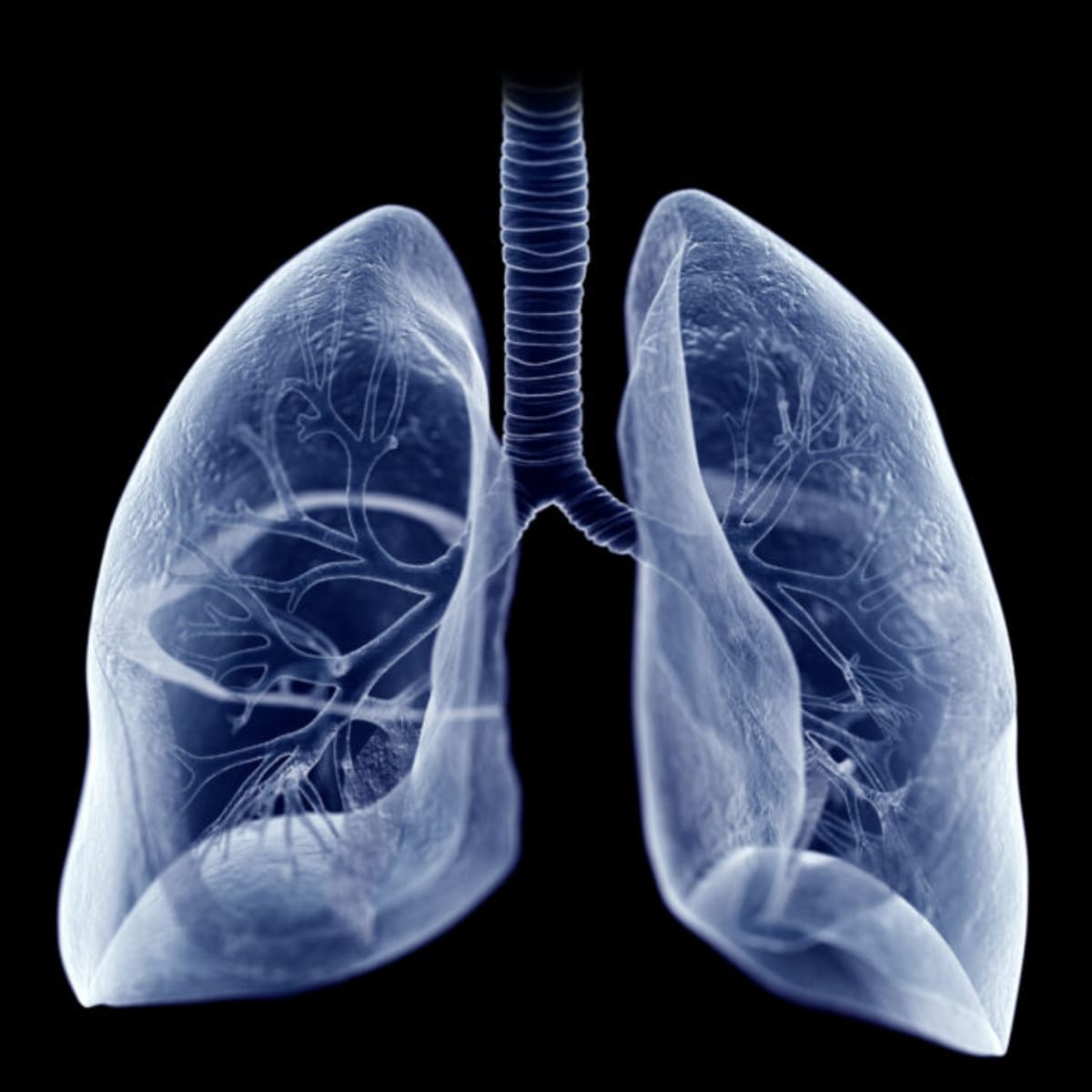 Lung Disease Drug Shows Promise for Earlier Treatment - Image 2