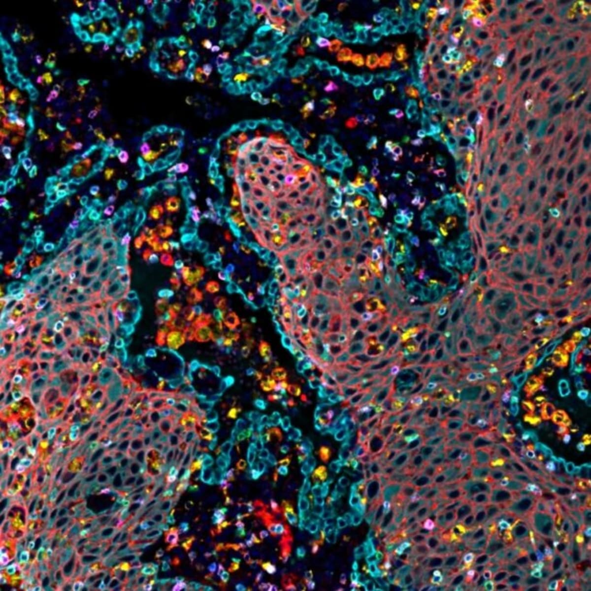 New Pancreatic Cancer Drug Shows Unprecedented Results - Image 2