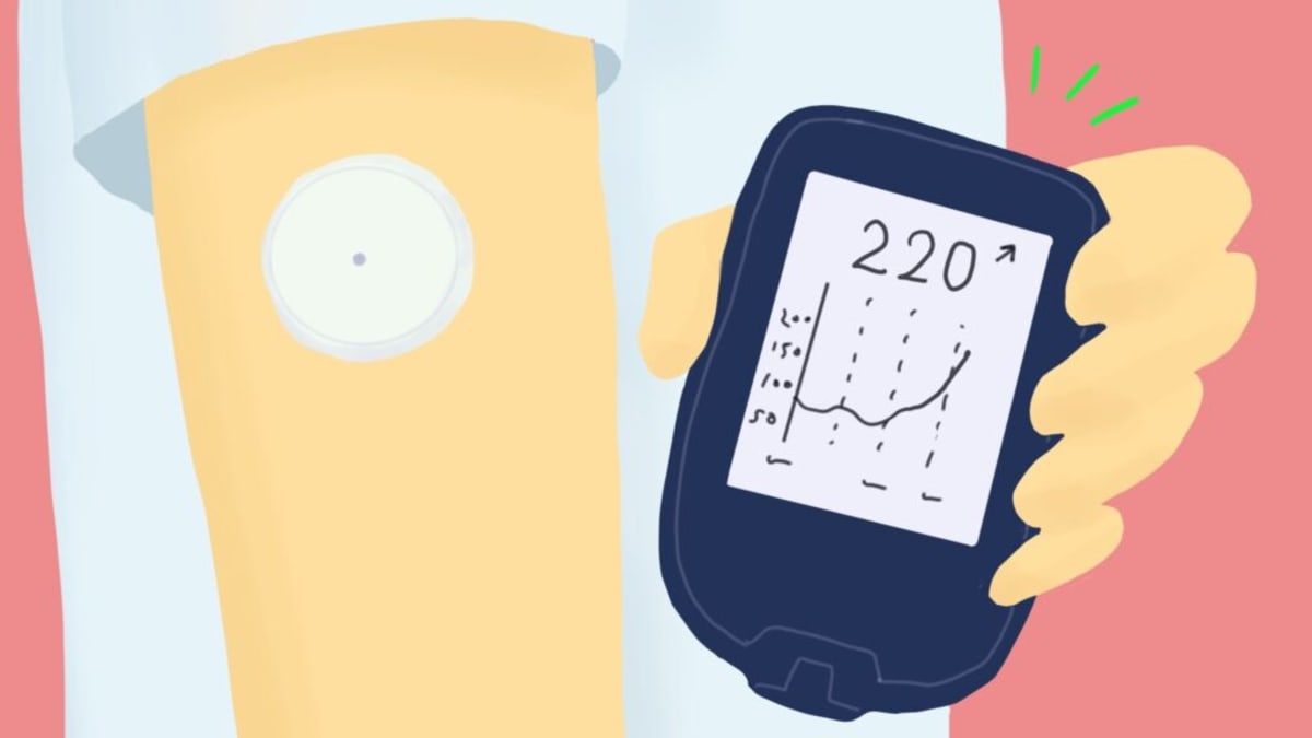 Glucose Monitor Helps Type 2 Diabetics Control Blood Sugar
