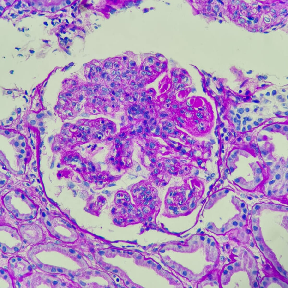 Lupus Patient Now Works in Clinic That Saved Her Life - Image 2