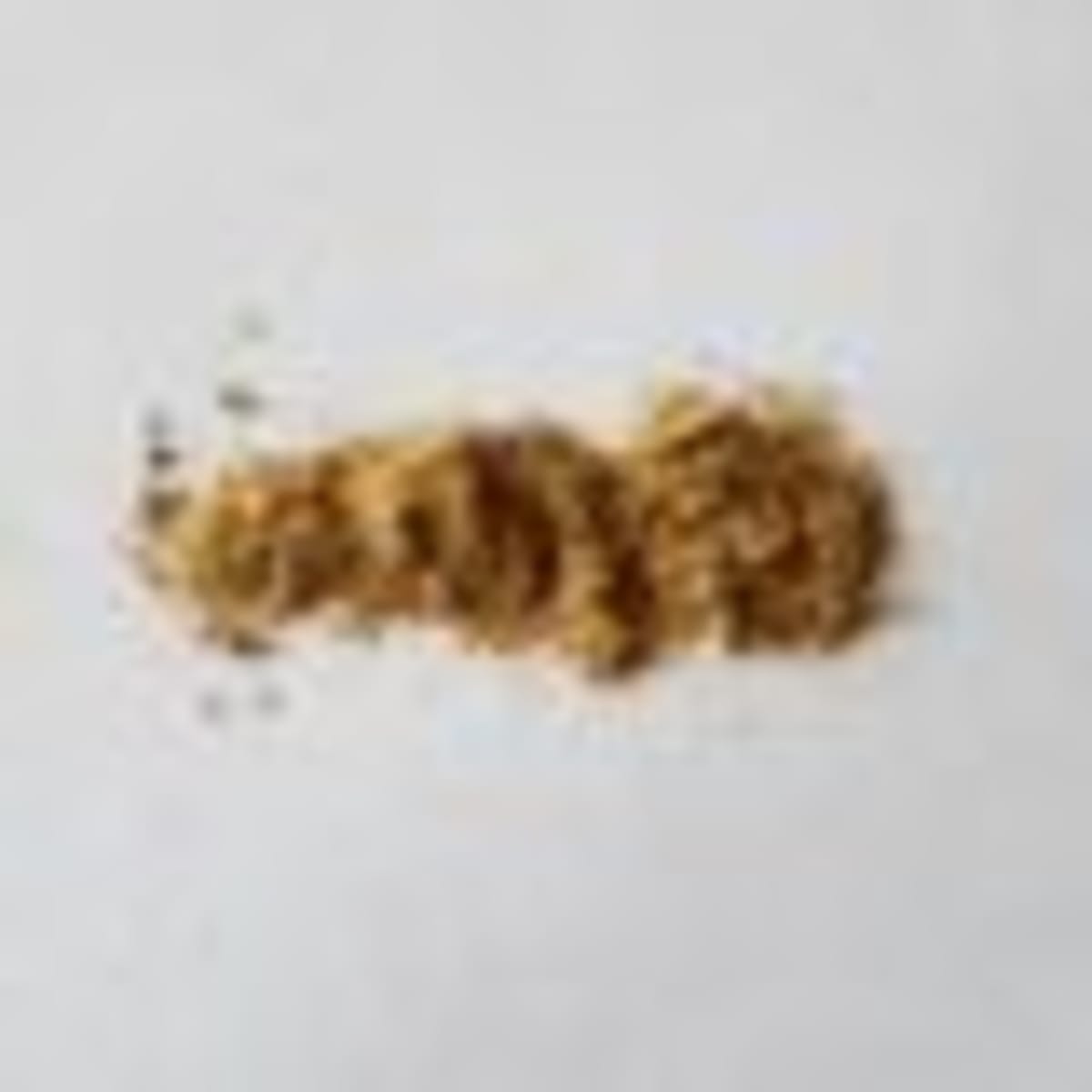 New Alopecia Drug Shows Hair Regrowth in 27% of Patients - Image 4