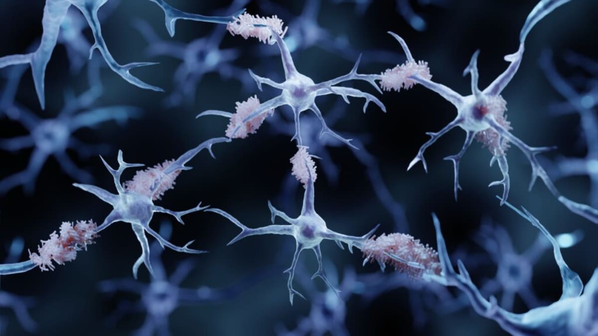 Scientists analyzing brain scan data on computer screens in modern research laboratory