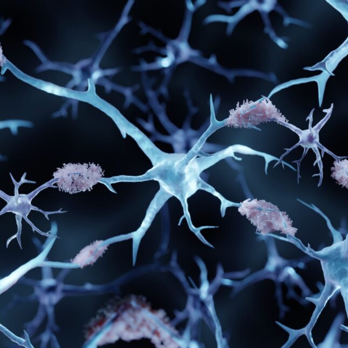 New Alzheimer's Drug Shows Safer Brain Scan Results - Image 2