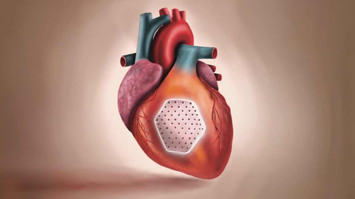 Stem Cell Heart Patches Help Failing Hearts Pump Again
