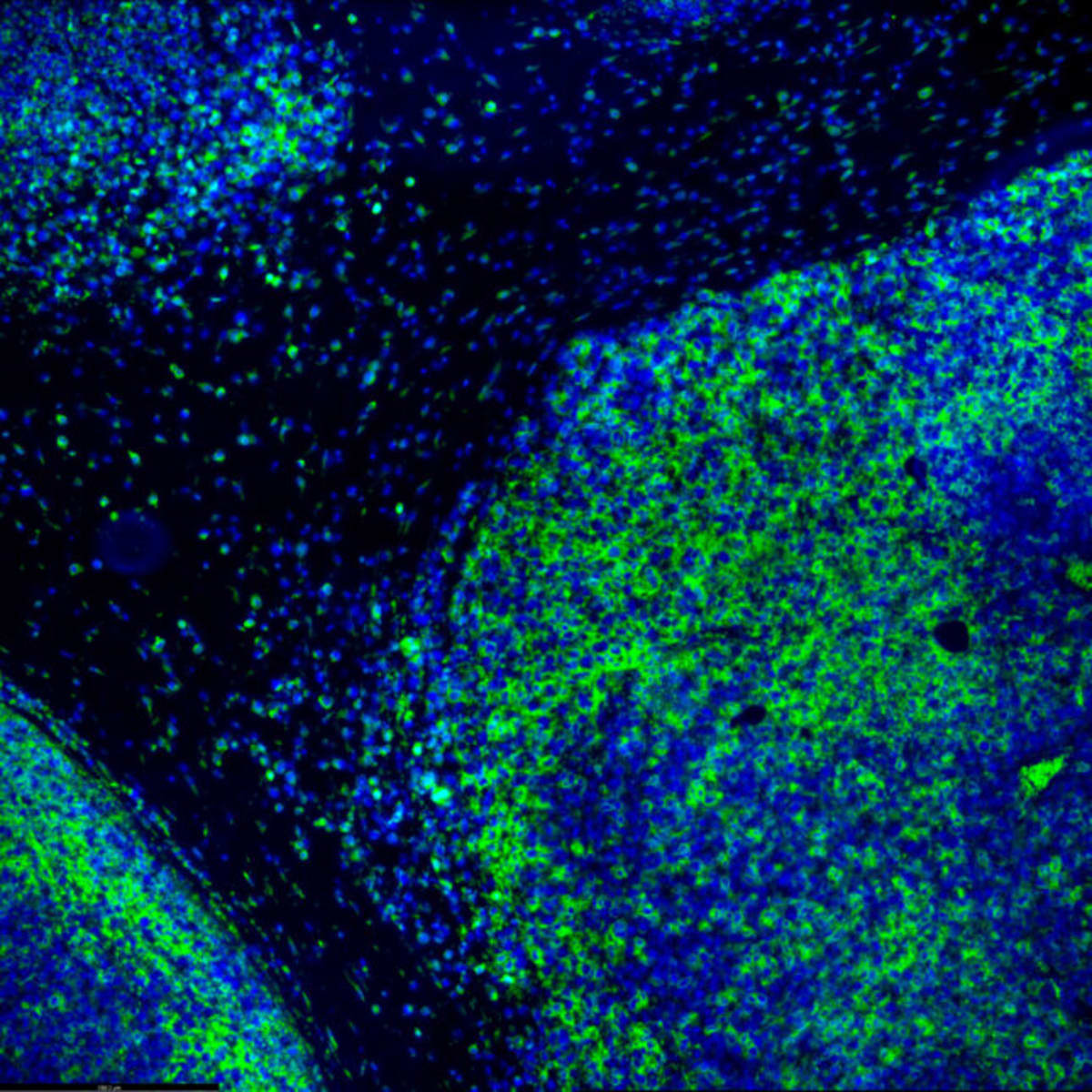 After 15 Years of Failures, Cancer Drug Shows Real Promise - Image 2