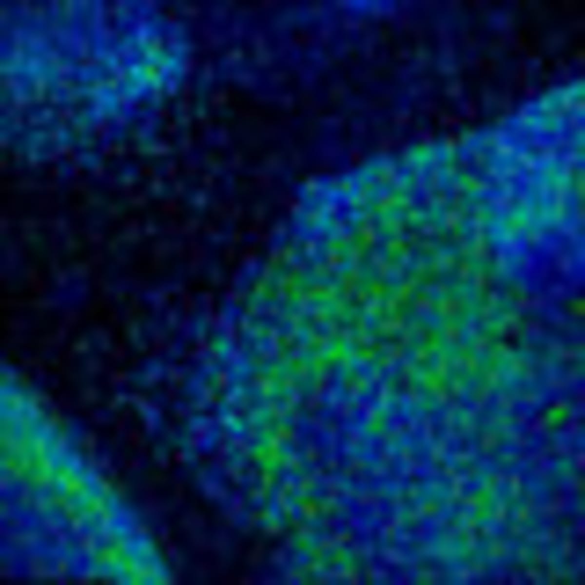 Cancer Drug Discovery Launches $50M Diabetes Startup - Image 5
