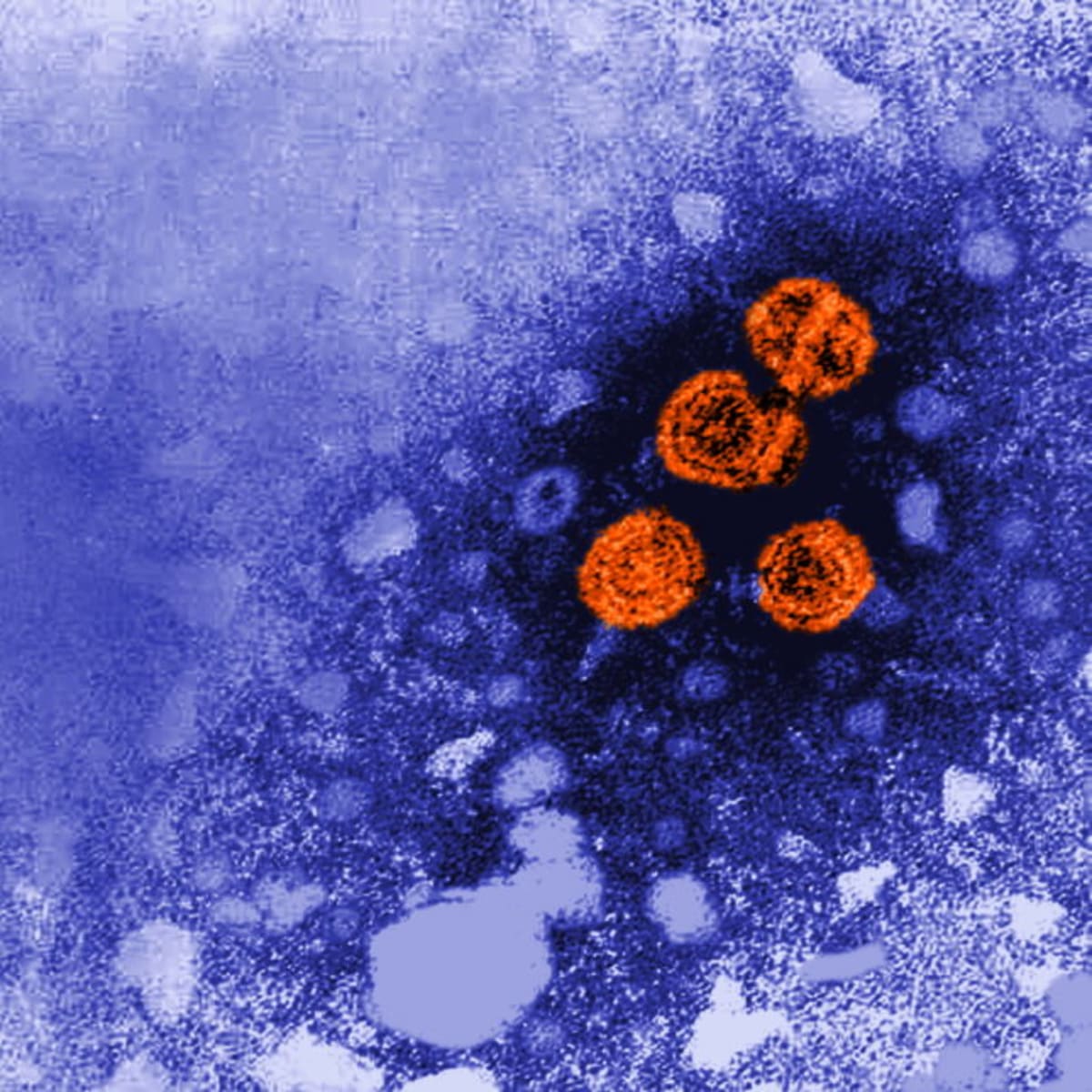 New Treatment Could Extend Preeclampsia Pregnancies Safely - Image 2