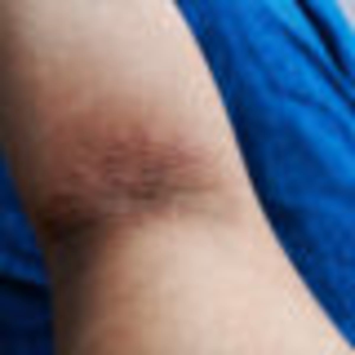 Lung Disease Drug Shows Promise for Earlier Treatment - Image 4