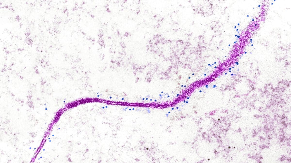 Scientists Find New Target for Cancer Immunotherapy