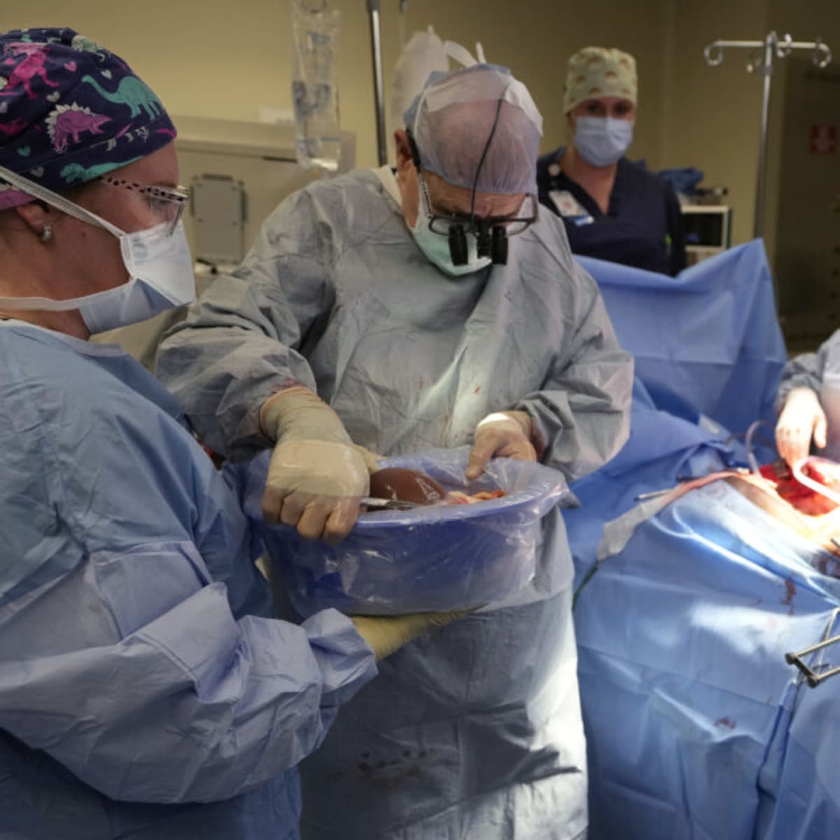 Cell Therapy Helps Liver Patients Skip Anti-Rejection Drugs - Image 2