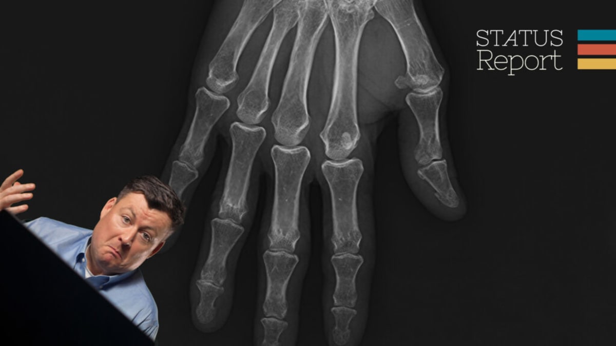 Computer screen showing side-by-side comparison of real and AI-generated medical X-ray images