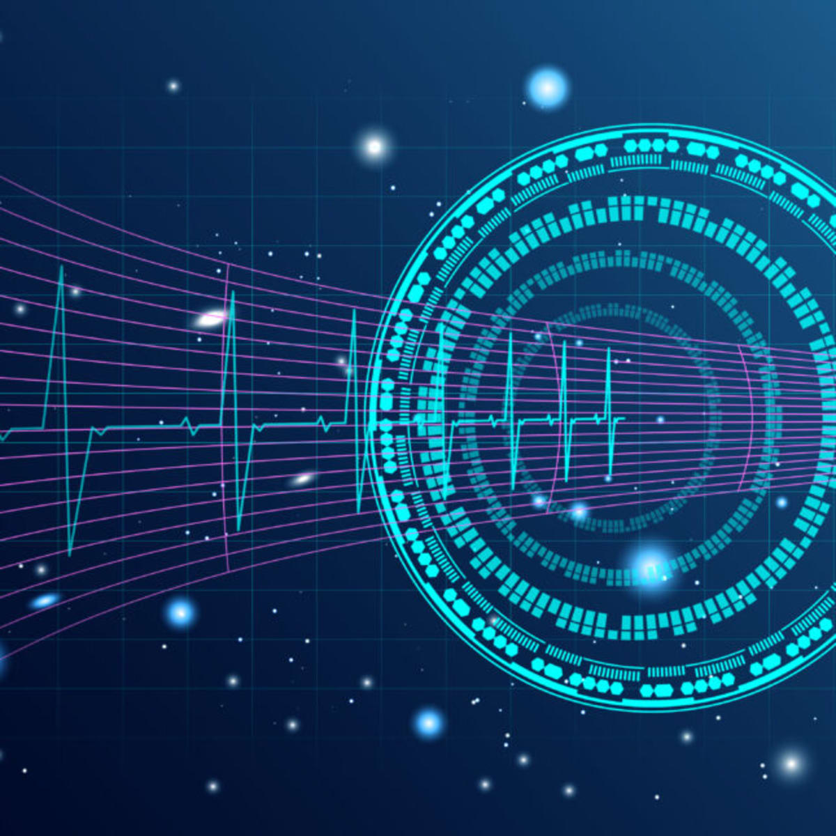 AI Tool Detects 6 Heart Conditions From Simple EKG Scans - Image 2