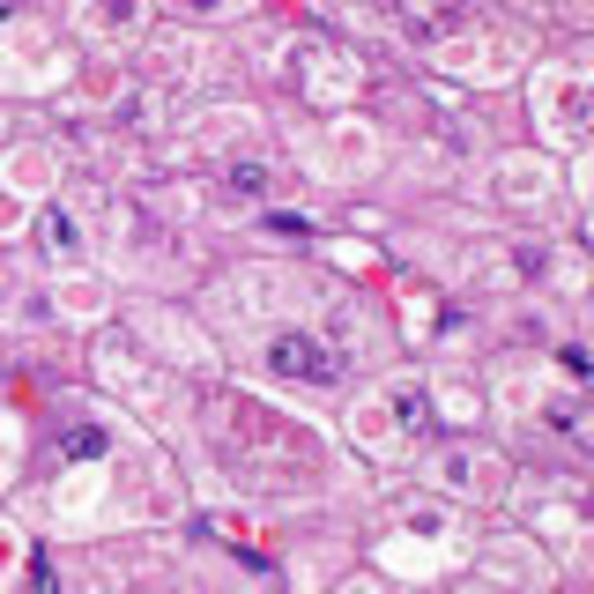 Lilly Grants Compassionate Access to Promising Obesity Drug - Image 4