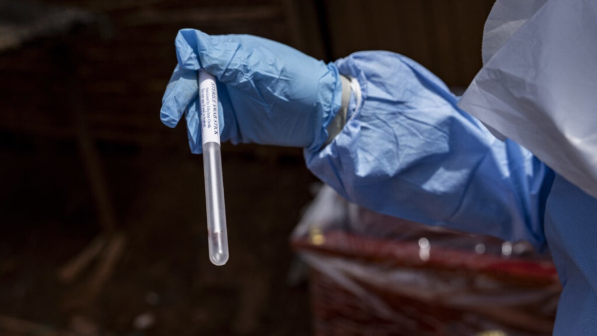 US Makes Experimental Ebola Treatment Available to Americans