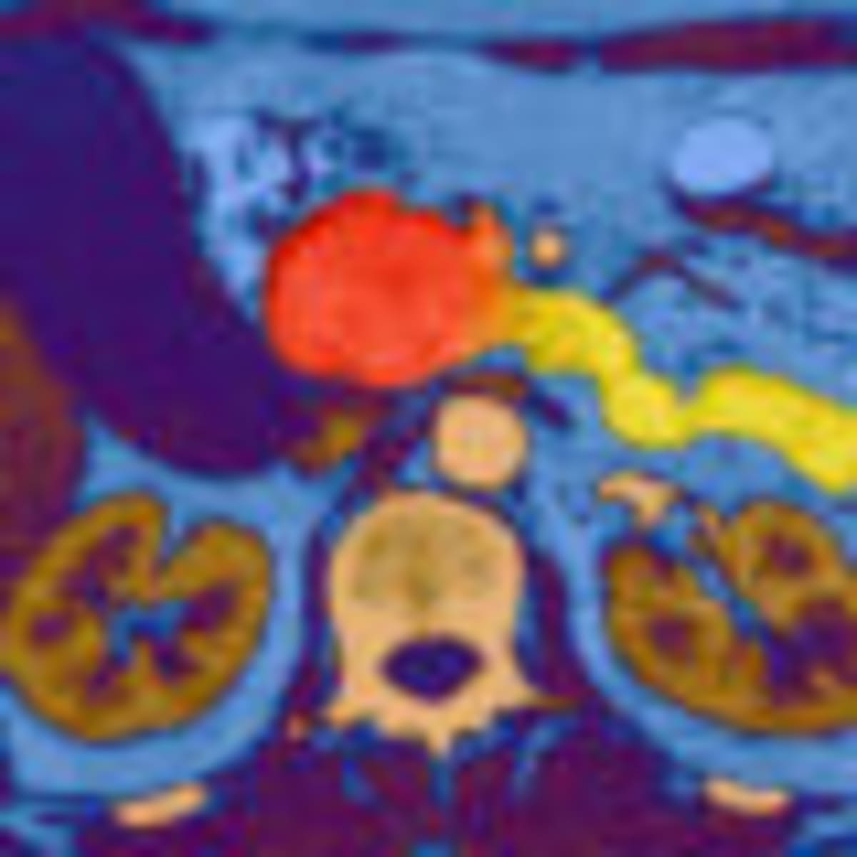 Dementia Study Confirms: Lifestyle Changes Protect Your Brain - Image 5